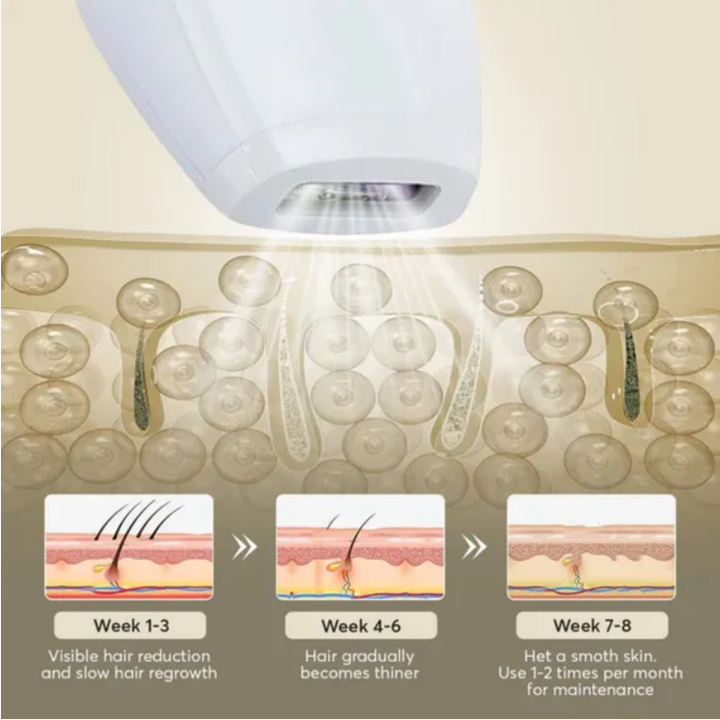 TSLO2 Professional Laser Hair Removal Device