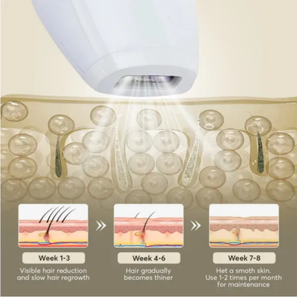 TSLO2 Professional Laser Hair Removal Device