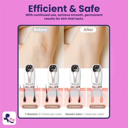 TSL03 IPL Hair Remover | At-Home Laser Pakistan