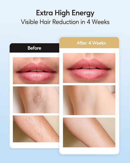 TSLO8 Elite Rechargable IPL Laser Hair Removal Device
