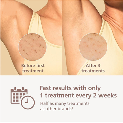 TSLO8 Elite Rechargable IPL Laser Hair Removal Device